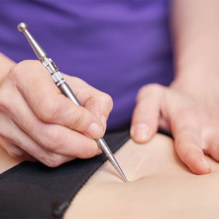 narbenentstoerung, mit einem metalstift wird eine narbe behandelt
